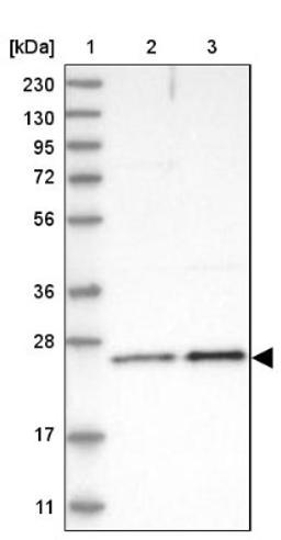 Western Blot: Methionine Sulfoxide Reductase A Antibody [NBP1-87456] - Lane 1: Marker [kDa] 230, 130, 95, 72, 56, 36, 28, 17, 11<br/>Lane 2: Human cell line RT-4<br/>Lane 3: Human cell line U-251MG sp