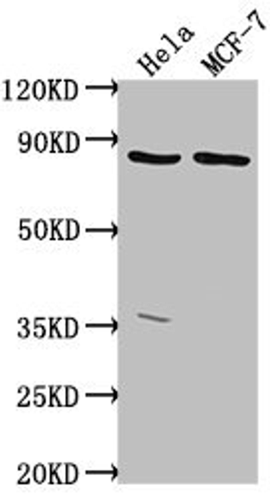 Western Blot. Positive WB detected in: Hela whole cell lysate, MCF-7 whole cell lysate. All lanes: TTC39B antibody at 1:2000. Secondary. Goat polyclonal to rabbit IgG at 1/50000 dilution. Predicted band size: 77, 67, 76, 60, 70, 23 kDa. Observed band size: 77 kDa. 