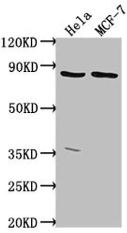 Western Blot. Positive WB detected in: Hela whole cell lysate, MCF-7 whole cell lysate. All lanes: TTC39B antibody at 1:2000. Secondary. Goat polyclonal to rabbit IgG at 1/50000 dilution. Predicted band size: 77, 67, 76, 60, 70, 23 kDa. Observed band size: 77 kDa. 