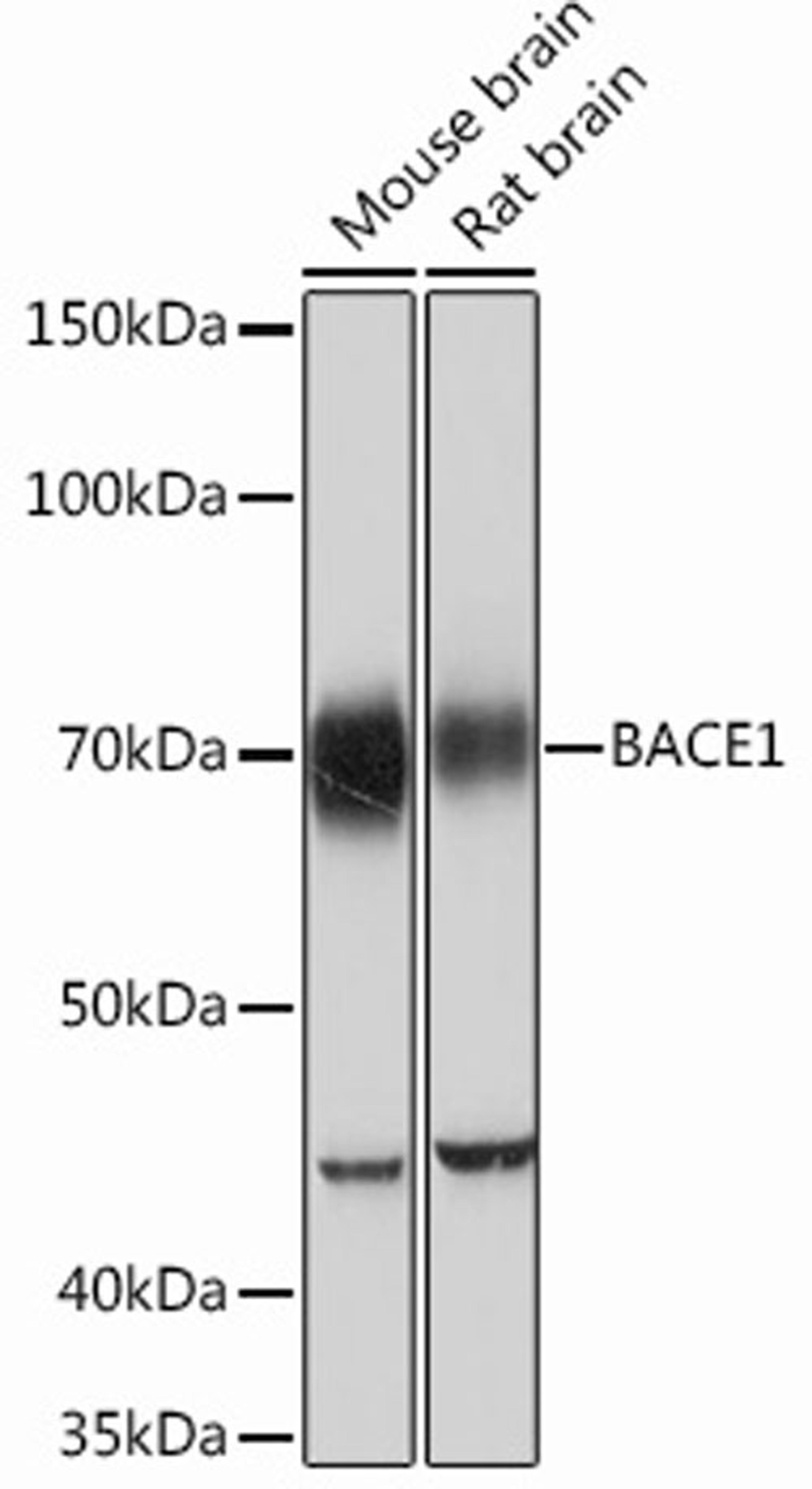 Western blot - BACE1 Rabbit mAb (A11533)