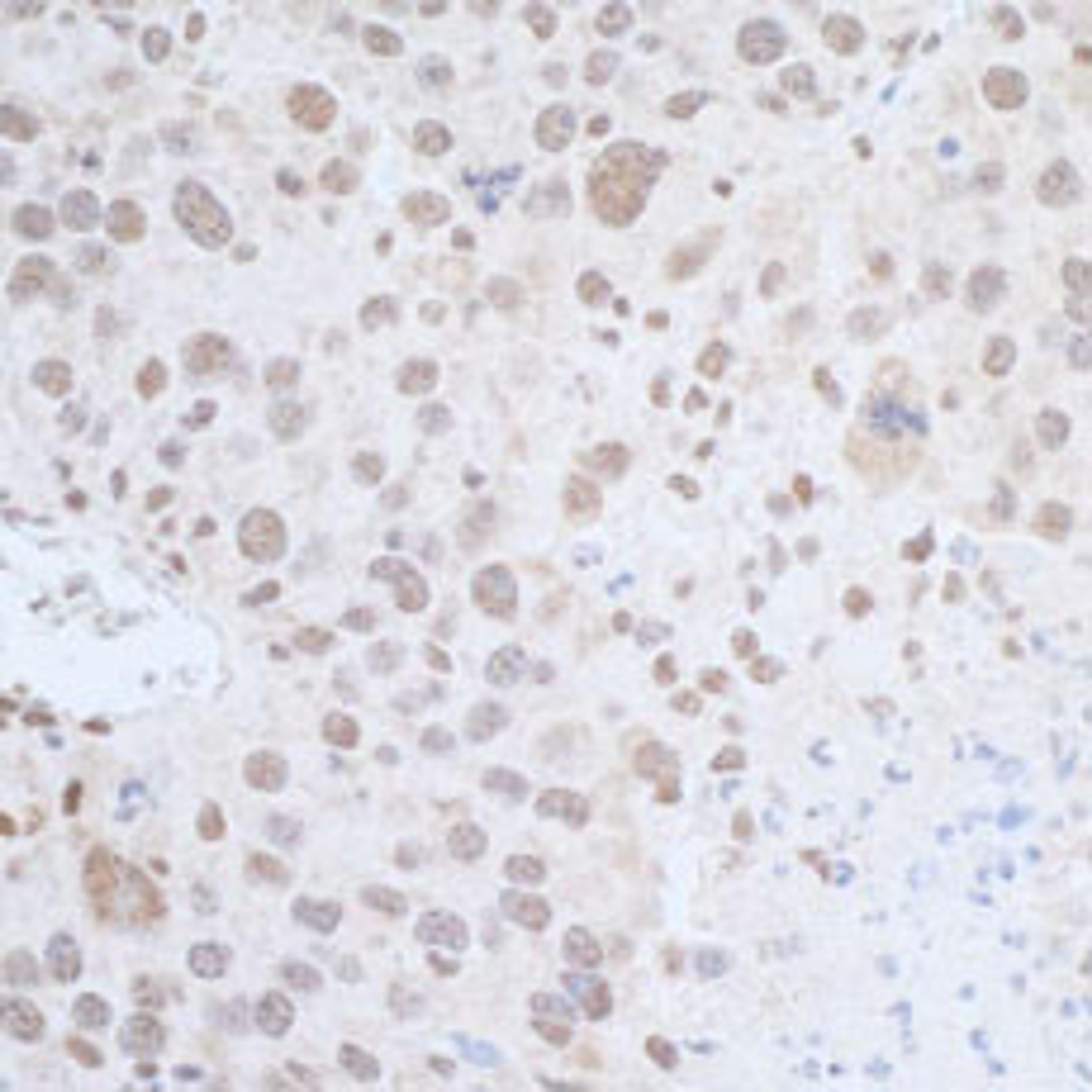 Detection of mouse Leo1 by immunohistochemistry.