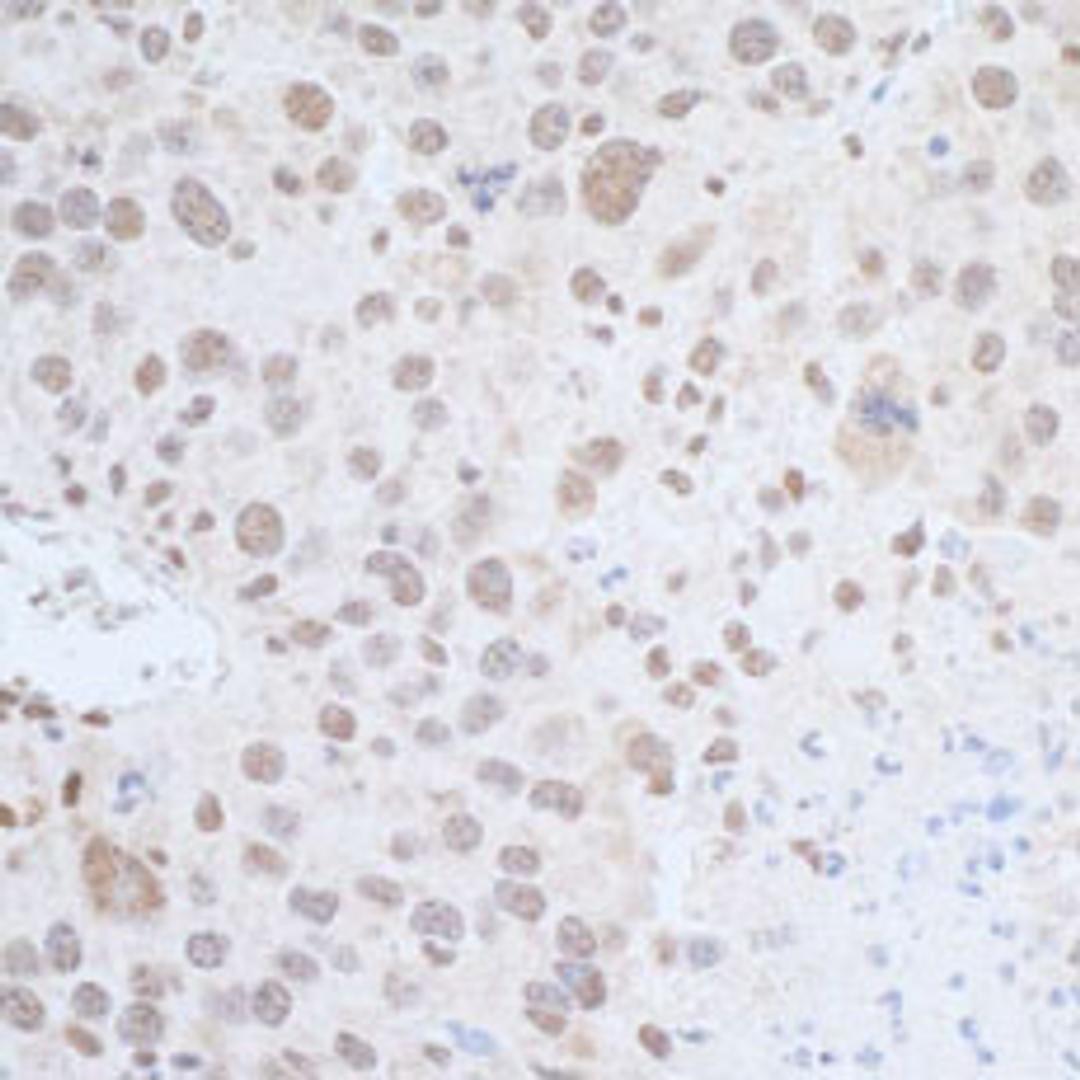 Detection of mouse Leo1 by immunohistochemistry.