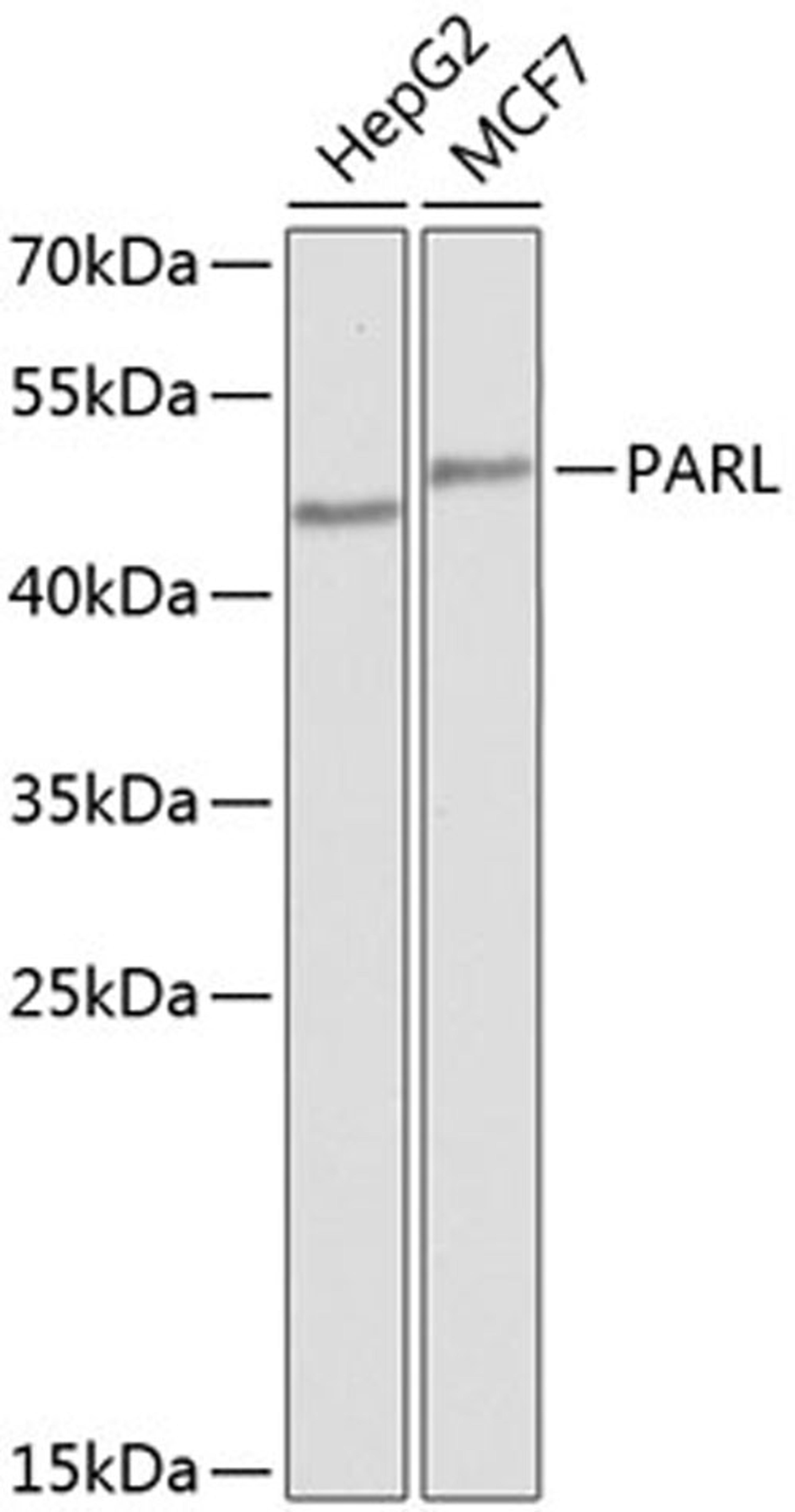 Western blot - PARL antibody (A8232)