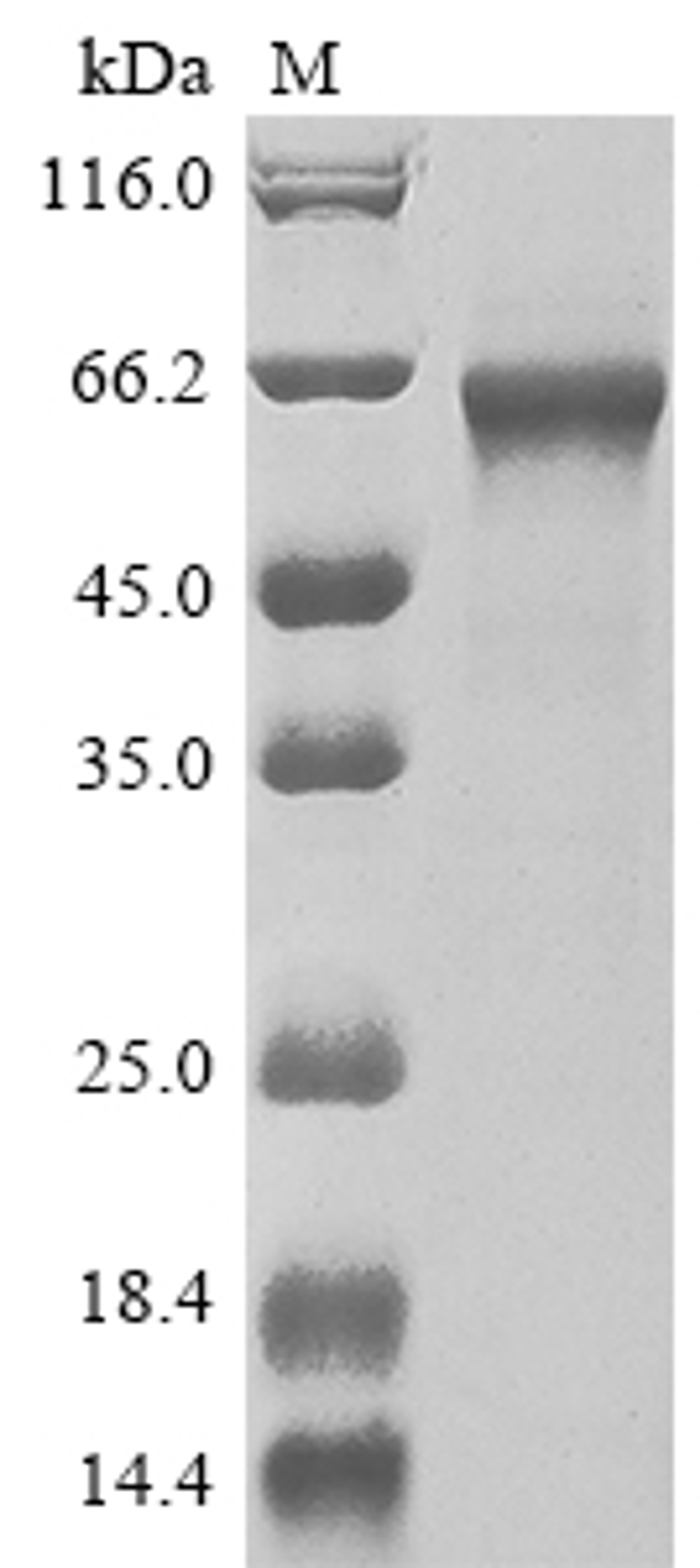 (Tris-Glycine gel) Discontinuous SDS-PAGE (reduced) with 5% enrichment gel and 15% separation gel.