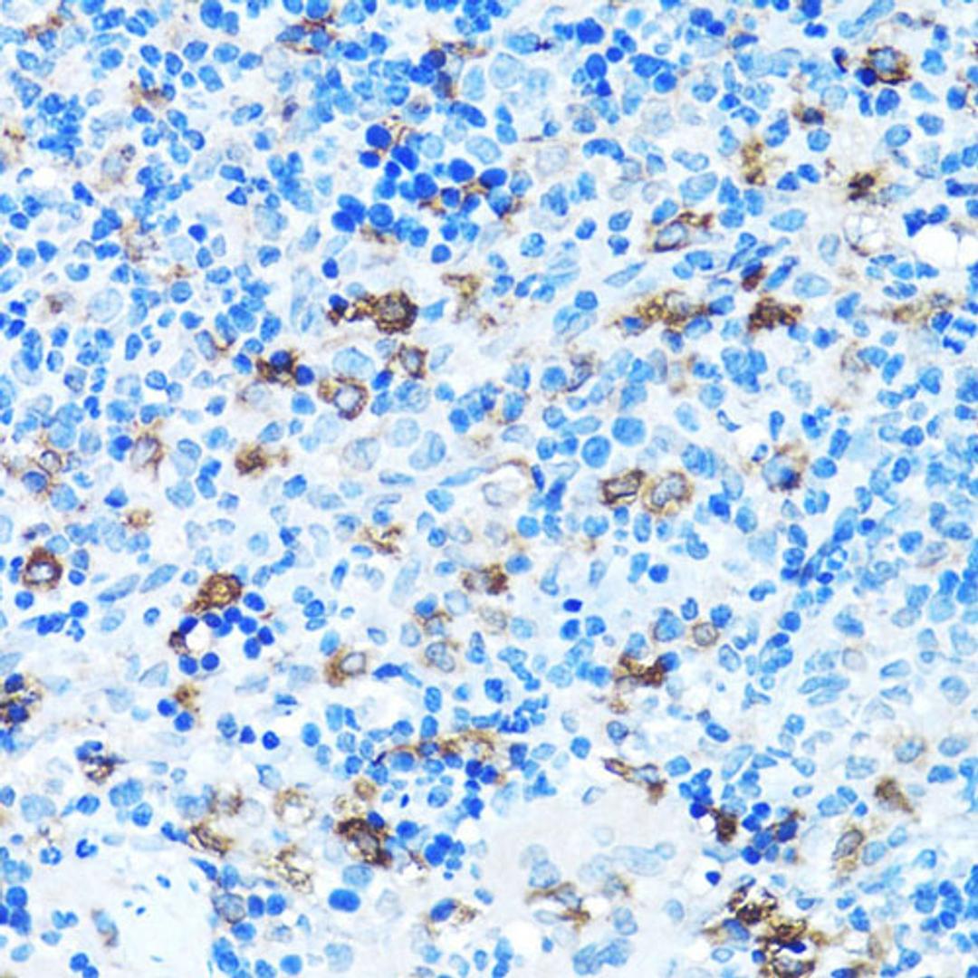 Immunohistochemistry - FGFR2 antibody (A2074)