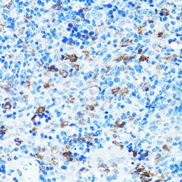 Immunohistochemistry - FGFR2 antibody (A2074)