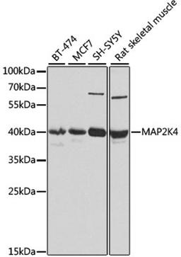 Western blot - MAP2K4 antibody (A7724)