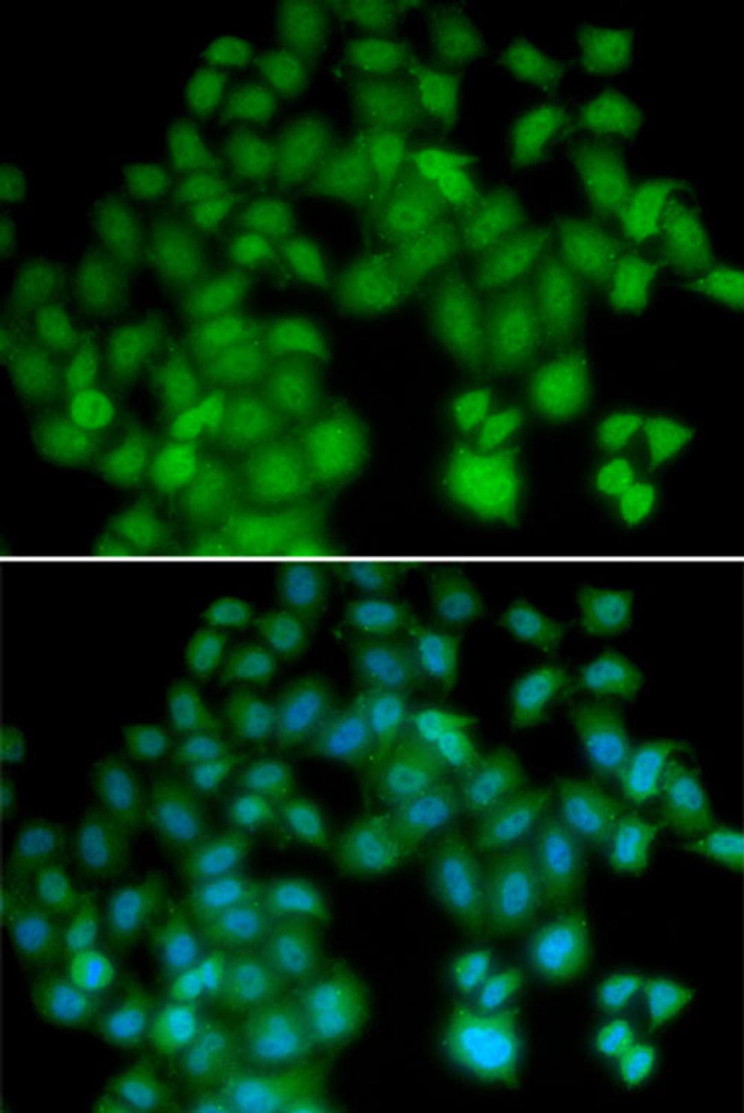 Immunofluorescence - TMSB4X antibody (A5438)