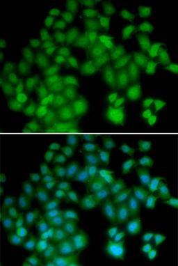 Immunofluorescence - TMSB4X antibody (A5438)