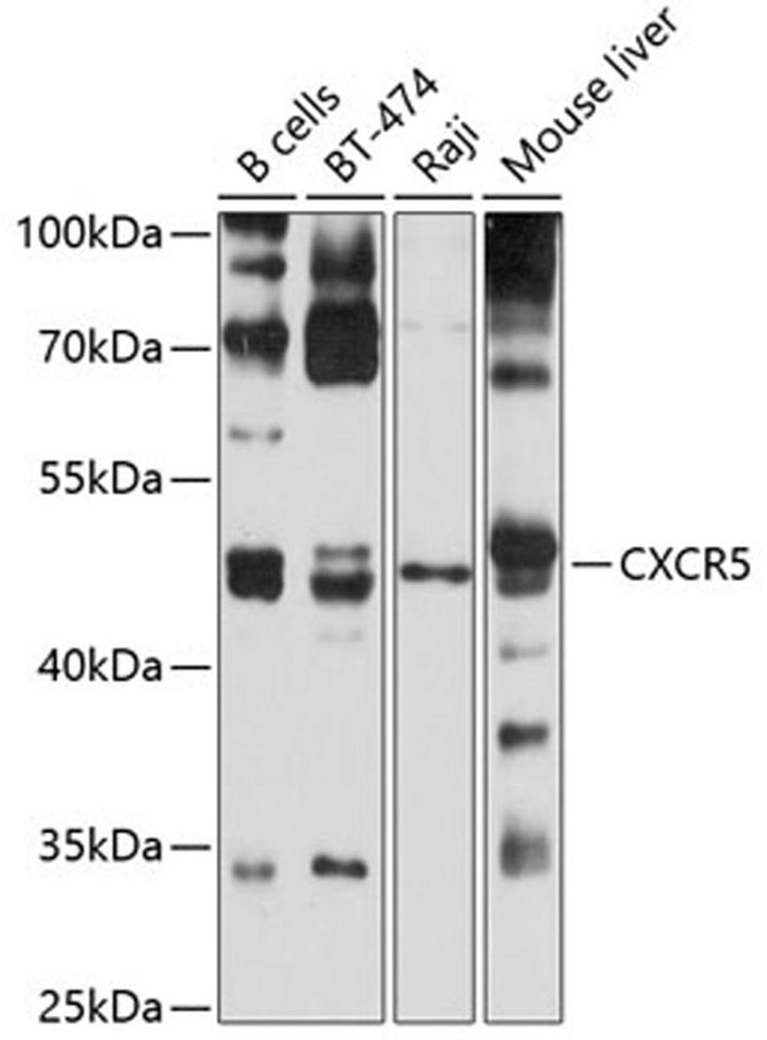 Western blot - CXCR5 antibody (A5268)