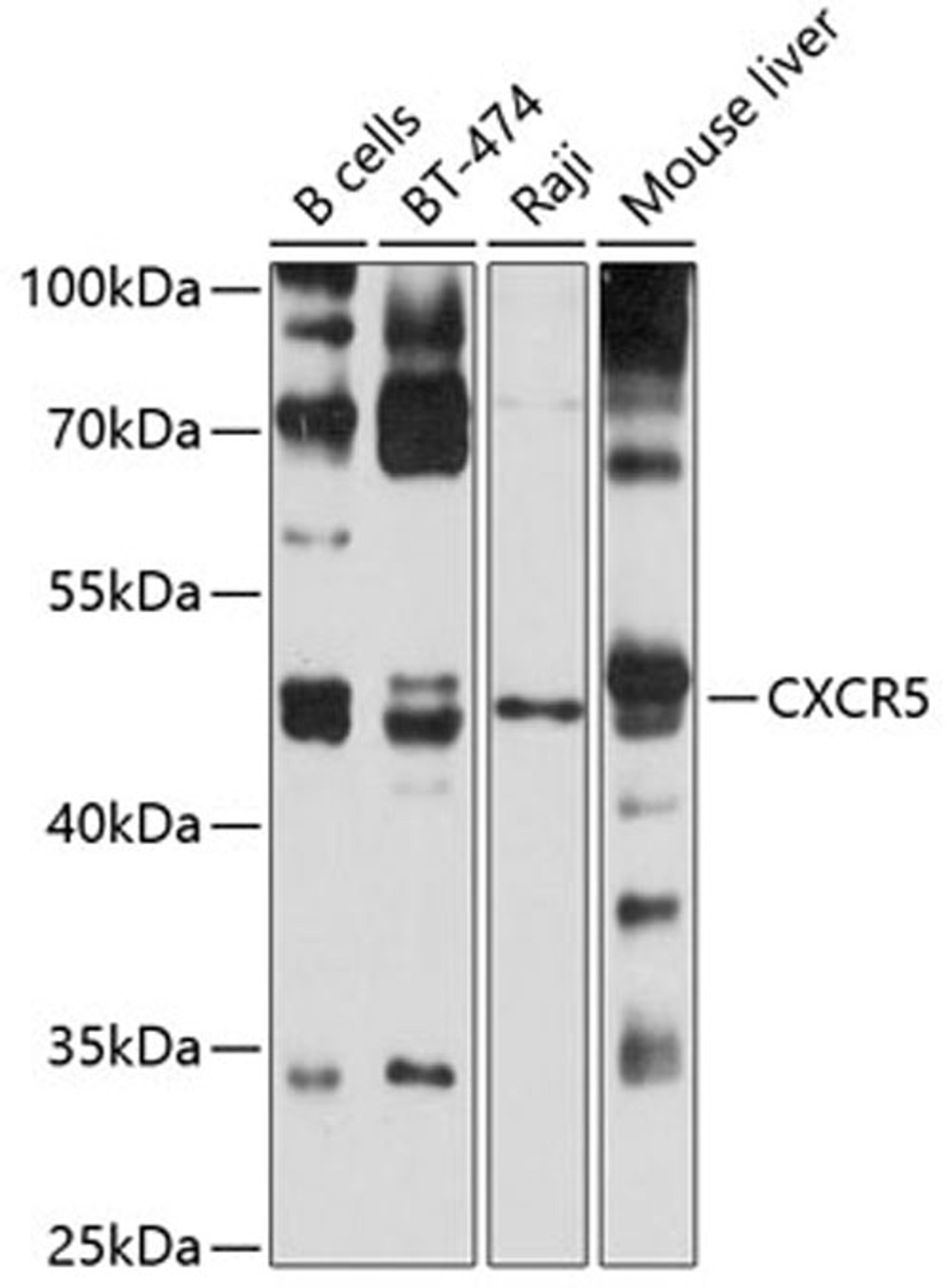 Western blot - CXCR5 antibody (A5268)