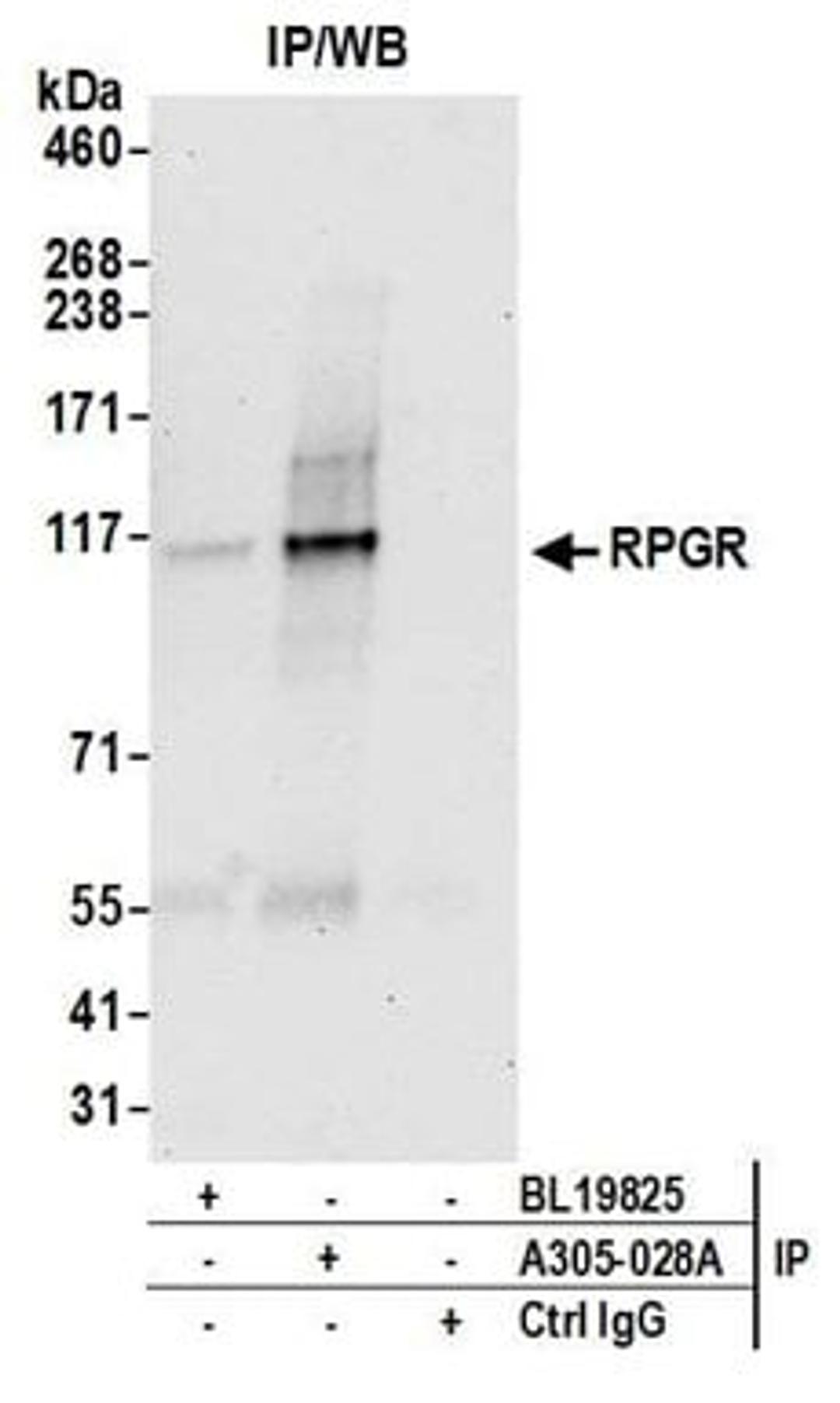 Detection of human RPGR by western blot of immunoprecipitates.