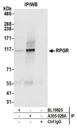 Detection of human RPGR by western blot of immunoprecipitates.