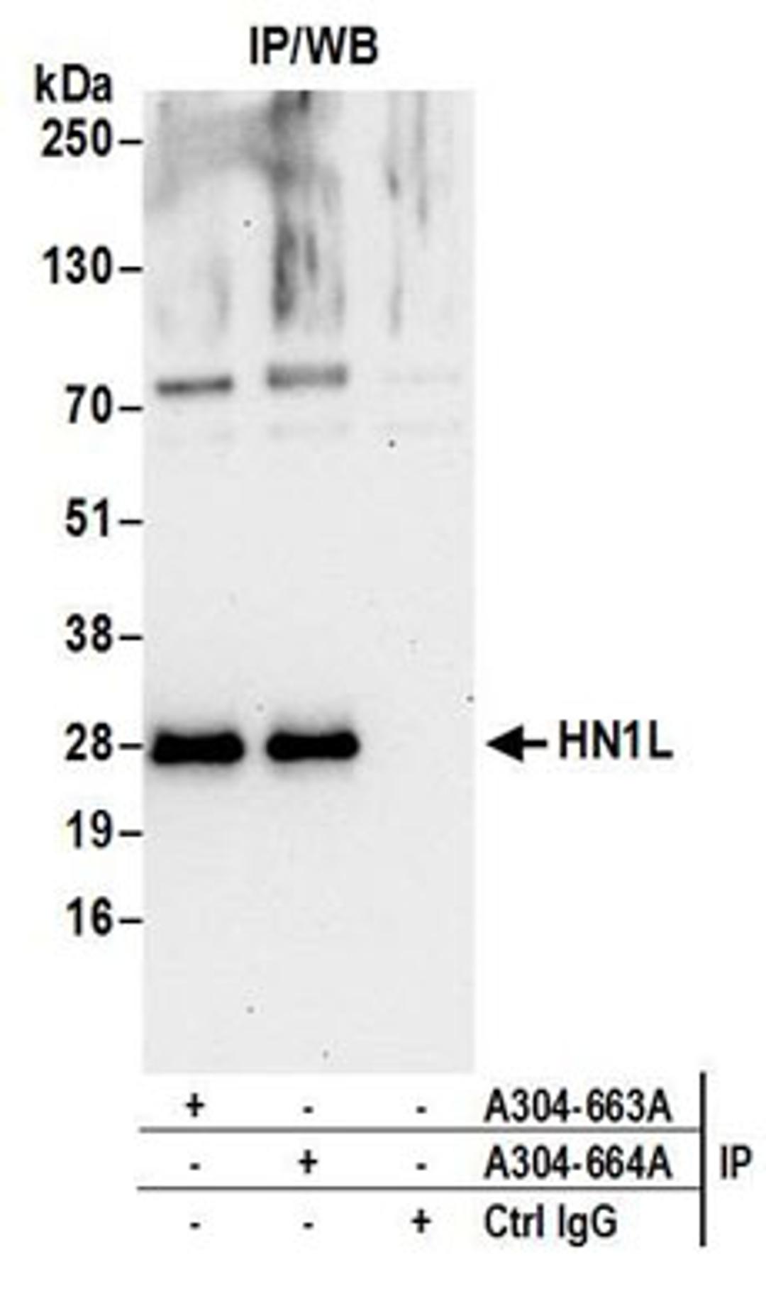 Detection of human HN1L by western blot of immunoprecipitates.