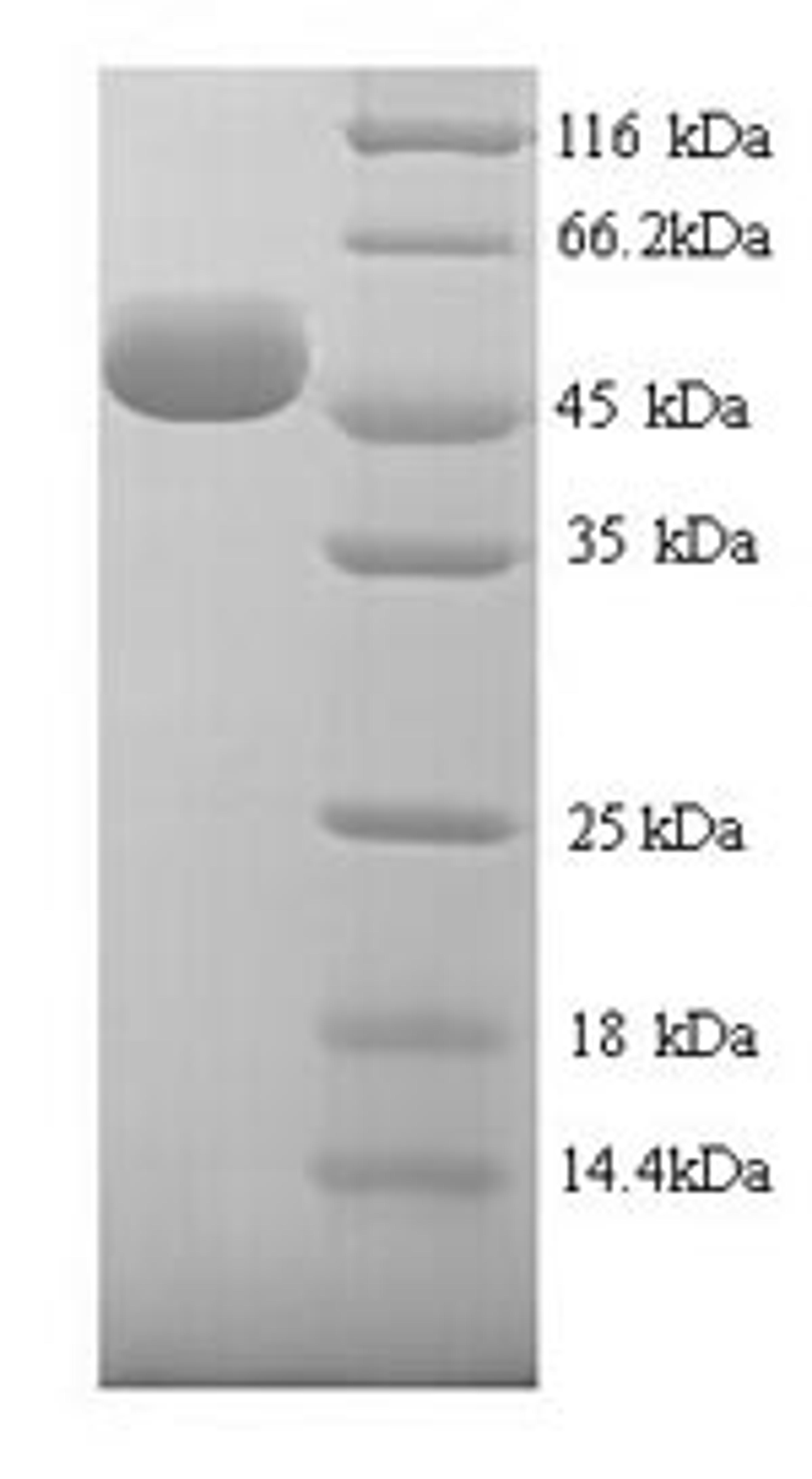 (Tris-Glycine gel) Discontinuous SDS-PAGE (reduced) with 5% enrichment gel and 15% separation gel.
