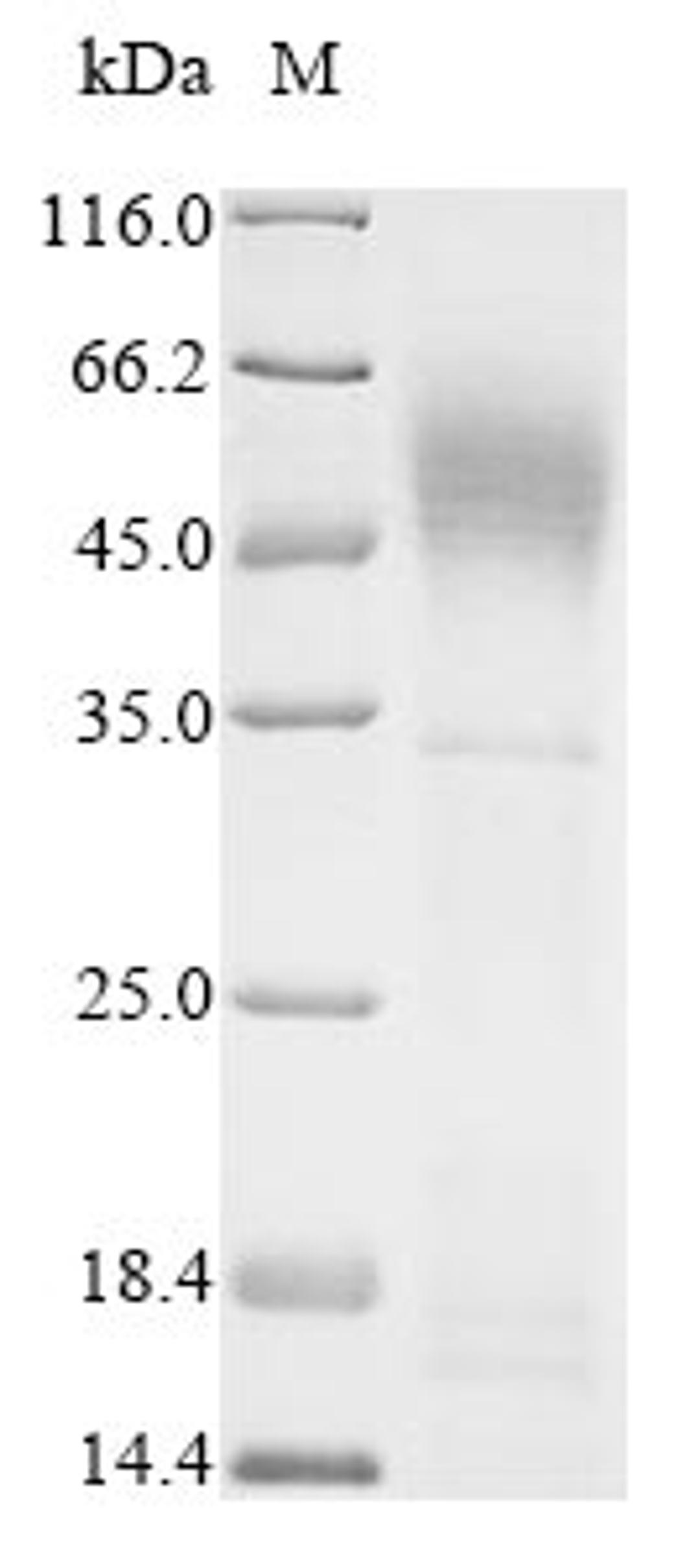 (Tris-Glycine gel) Discontinuous SDS-PAGE (reduced) with 5% enrichment gel and 15% separation gel.