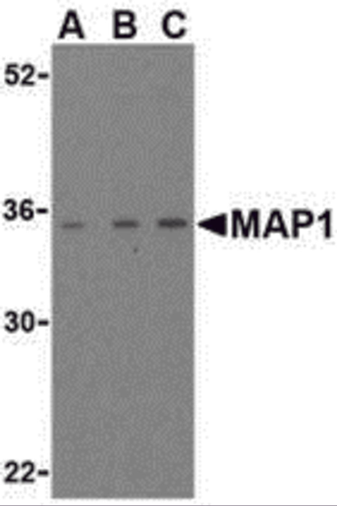 Western blot analysis of MAP-1 in EL4 cell lysate with MAP-1 antibody (IN) at (A) 1, (B) 2, and (C) 4 μg/mL.
