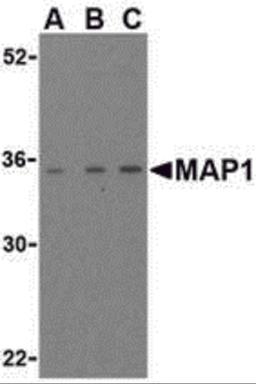 Western blot analysis of MAP-1 in EL4 cell lysate with MAP-1 antibody (IN) at (A) 1, (B) 2, and (C) 4 μg/mL.