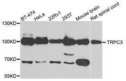 Western blot analysis of extracts of various cells using TRPC3 antibody