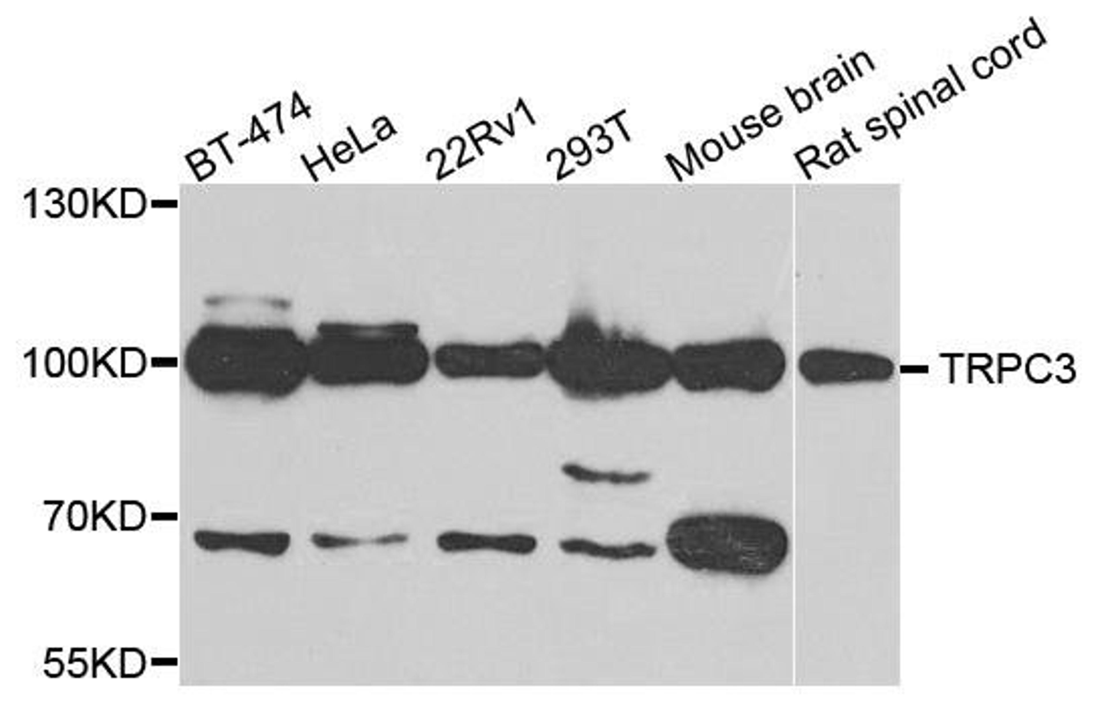 Western blot analysis of extracts of various cells using TRPC3 antibody