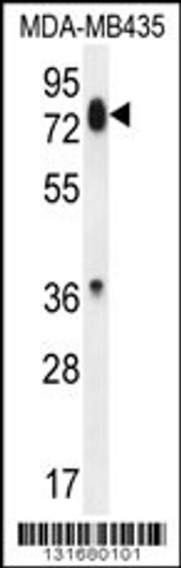 Western blot analysis in MDA-MB435 cell line lysates (35ug/lane).