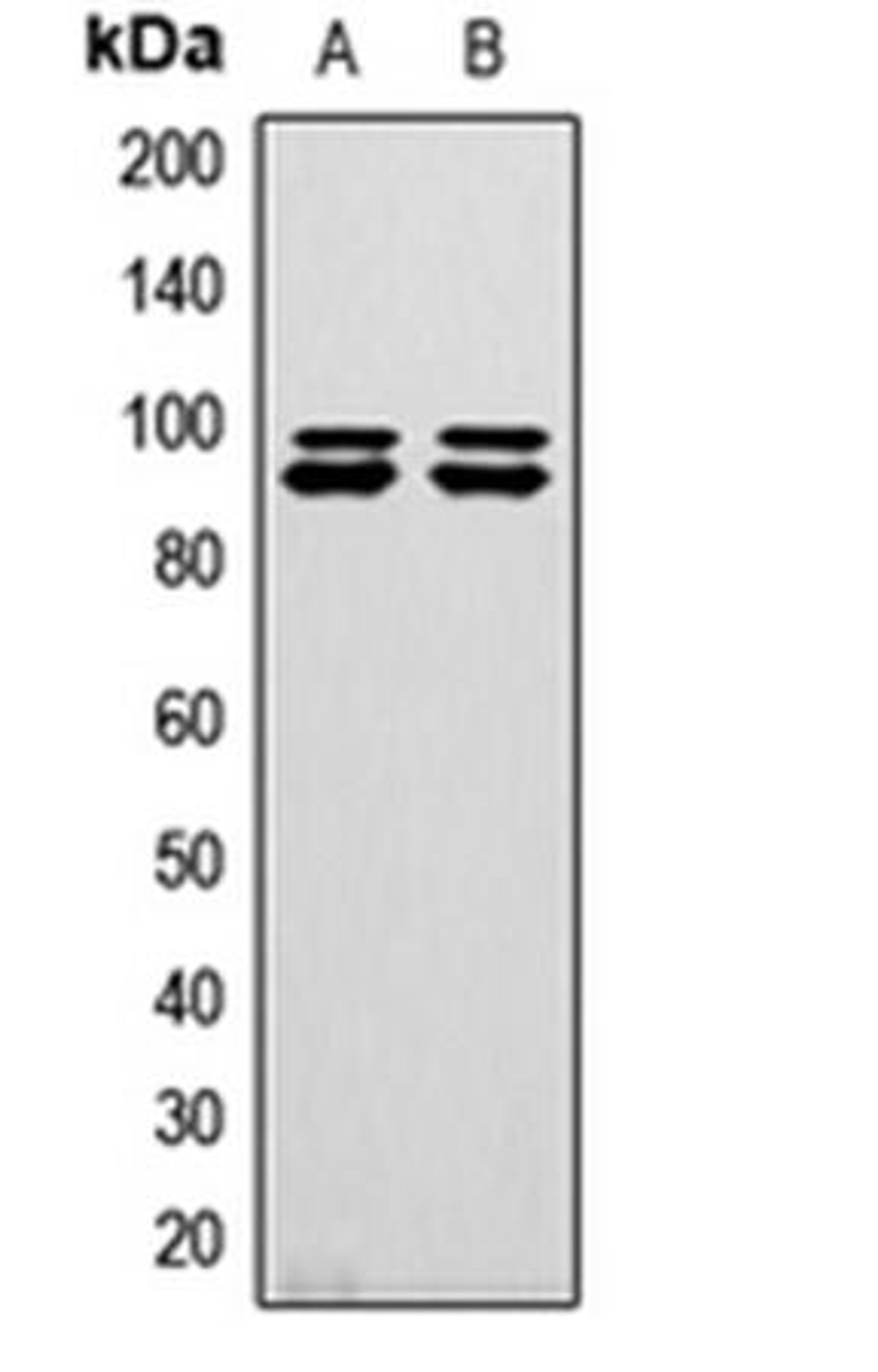 Western blot analysis of HeLa (Lane1), U2OS (Lane2) whole cell using GW antibody