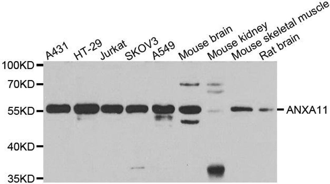 Western blot analysis of extracts of various cell lines using ANXA11 antibody