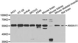 Western blot analysis of extracts of various cell lines using ANXA11 antibody
