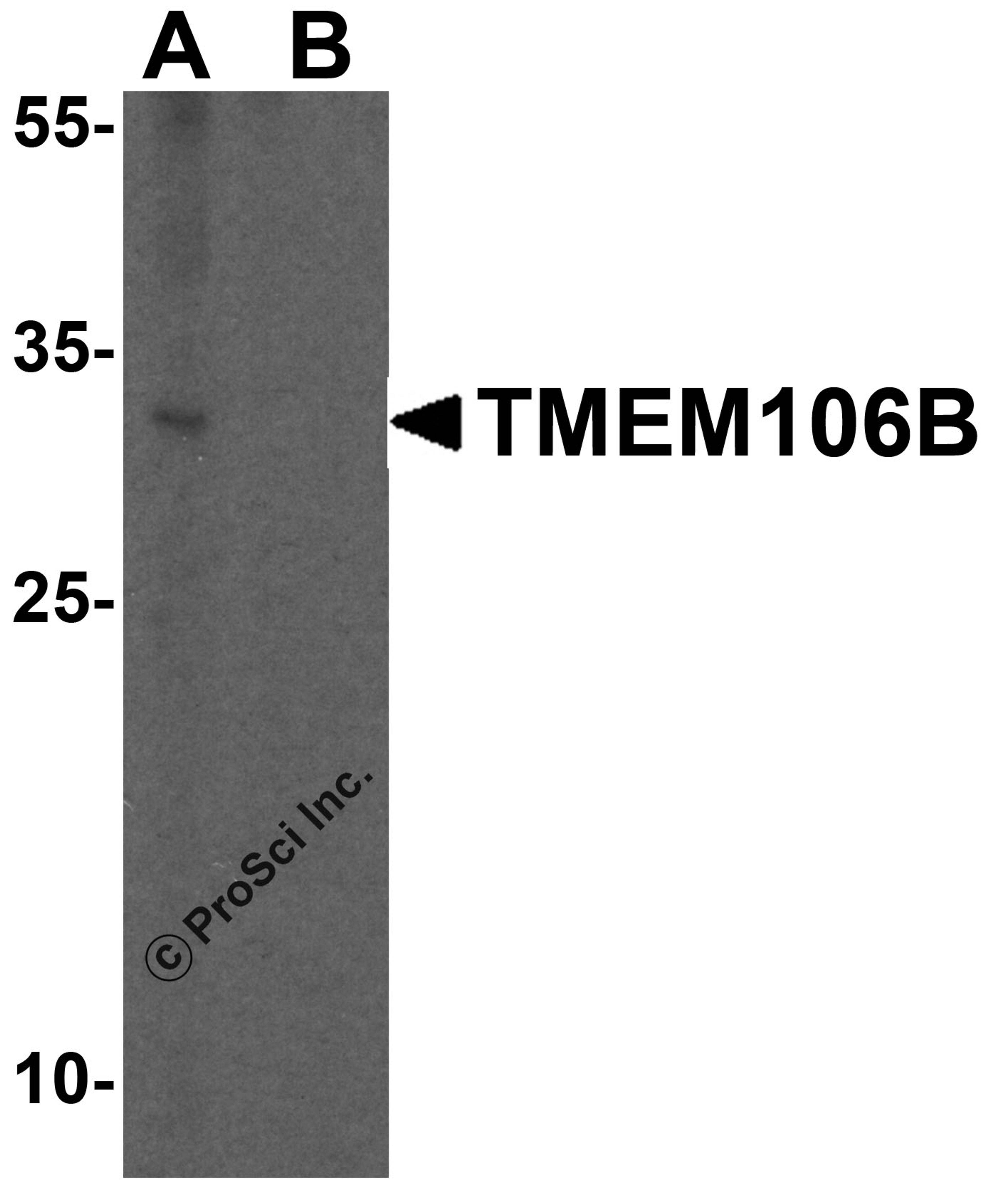Western blot analysis of TMEM106B in human brain tissue lysate with TMEM106B antibody at 1 μg/mL in (A) the absence and (B) the presence of blocking peptide.