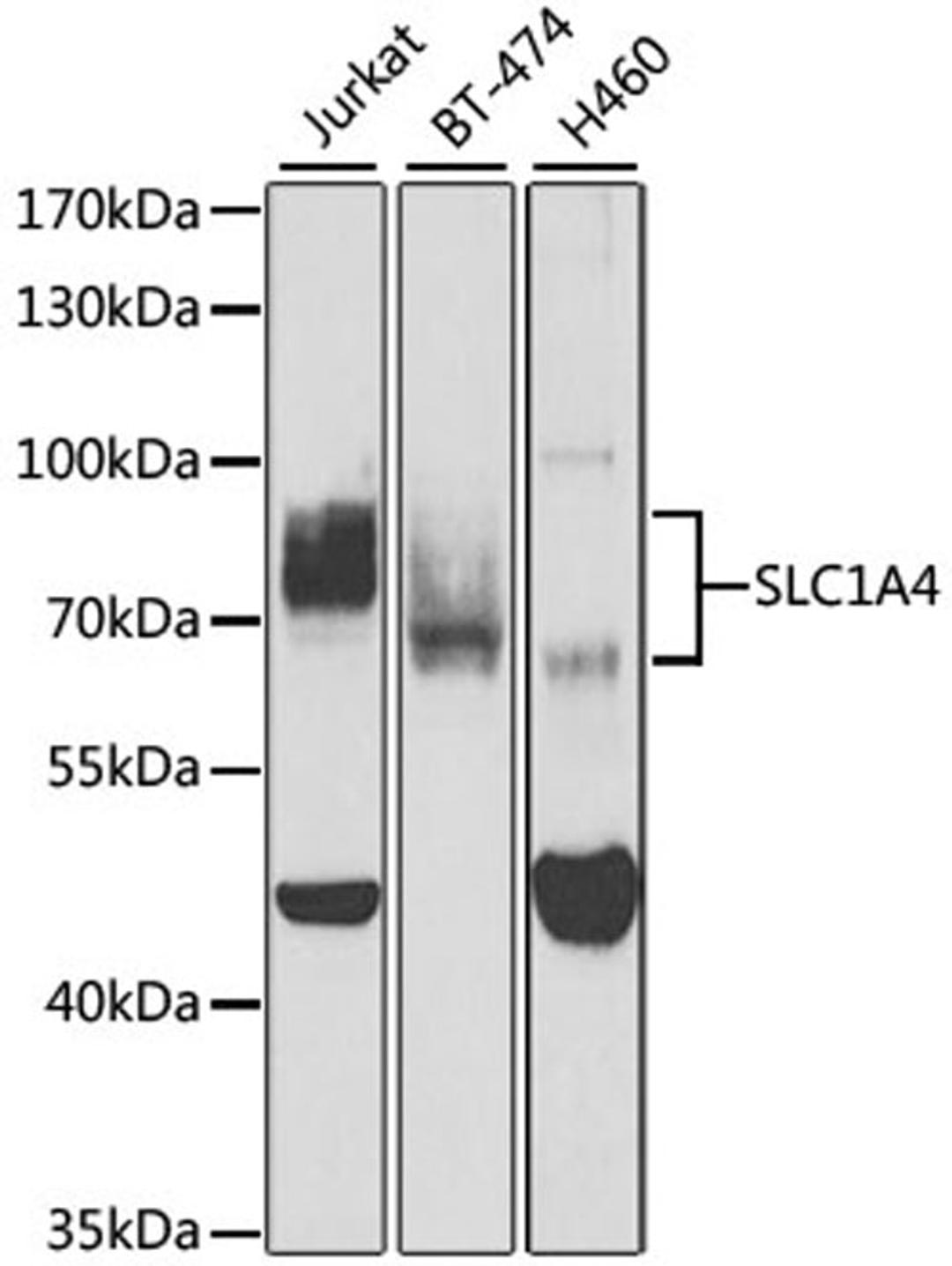 Western blot - SLC1A4 antibody (A3084)