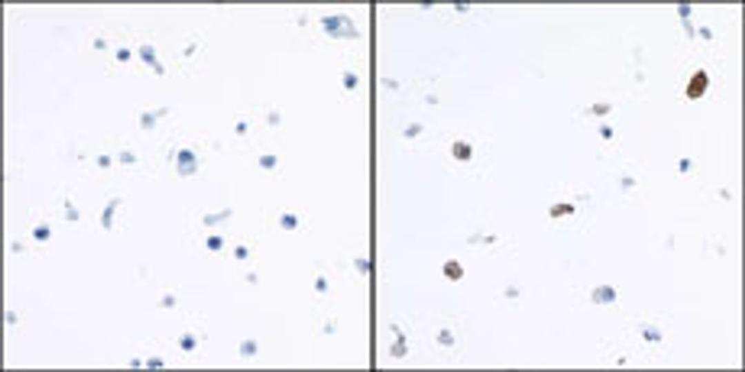 Detection of human IDO1 by immunocytochemistry.