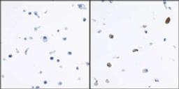 Detection of human IDO1 by immunocytochemistry.