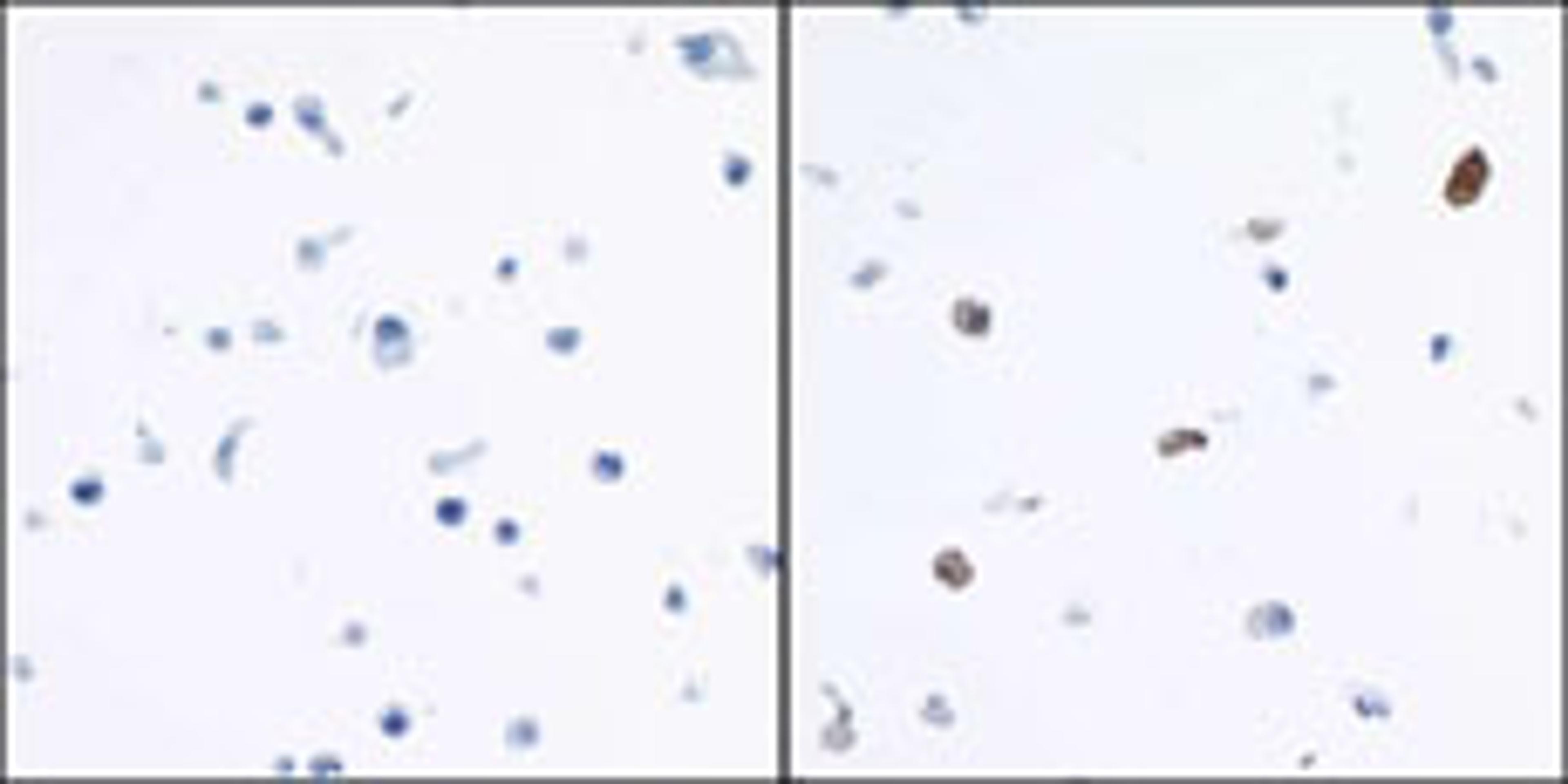 Detection of human IDO1 by immunocytochemistry.