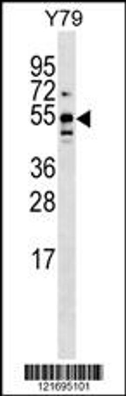 Western blot analysis in Y79 cell line lysates (35ug/lane).