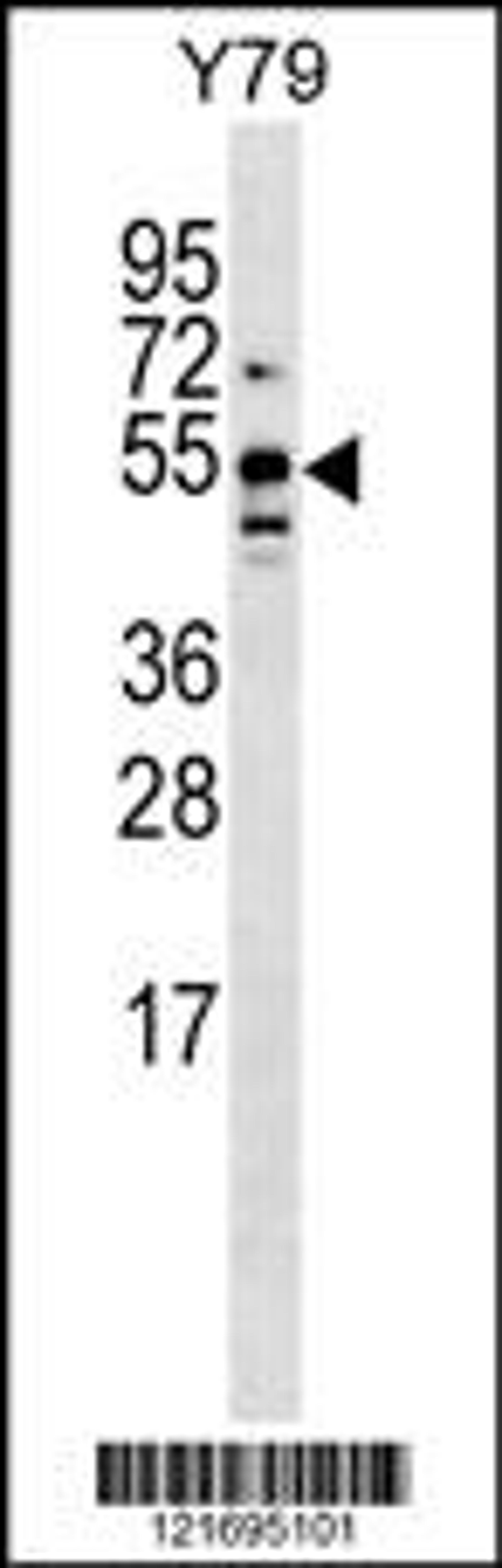 Western blot analysis in Y79 cell line lysates (35ug/lane).