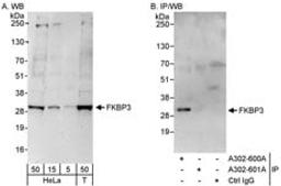 Detection of human FKBP3 by western blot and immunoprecipitation.