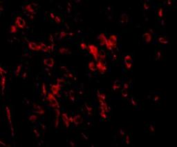 Immunocytochemistry/Immunofluorescence: SALM2/LRFN1 Antibody [NBP1-77345] - Immunofluorescence of LRFN1 in mouse brain tissue with LRFN1 antibody at 20 ug/mL.