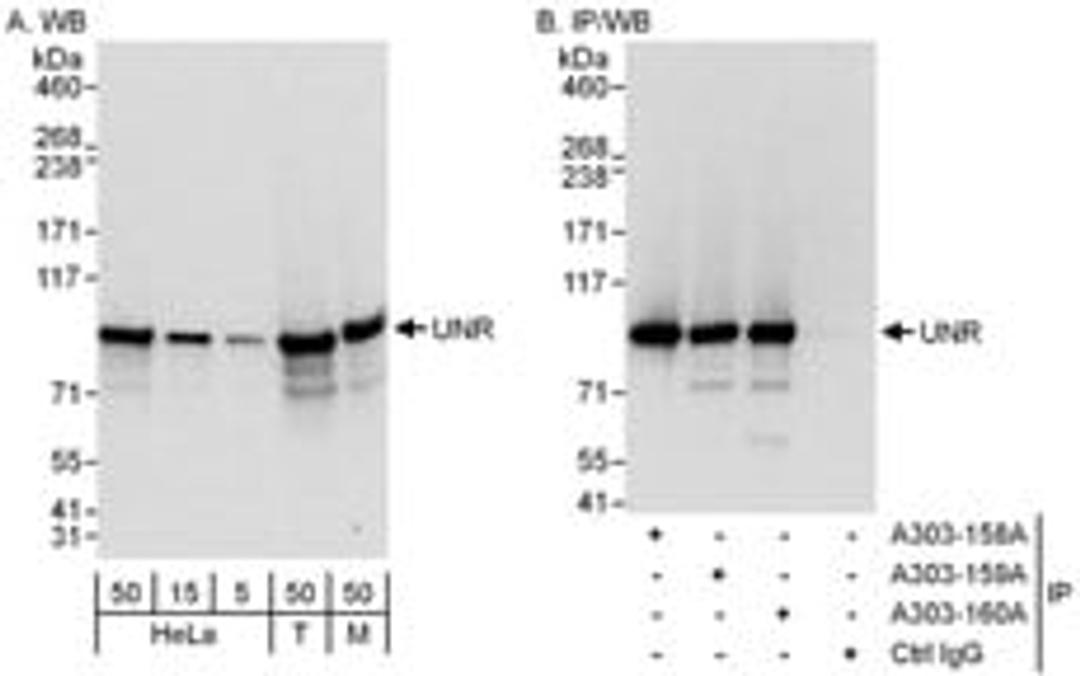 Detection of human and mouse UNR by western blot (h and m) and immunoprecipitation (h).