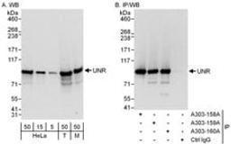 Detection of human and mouse UNR by western blot (h and m) and immunoprecipitation (h).