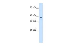 Antibody used in WB on Transfected 293T at 0.2-1 ug/ml.