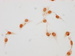 Immunocytochemistry analysis of CSB-PA010377OA17phHU diluted at 1:25 and staining in Hela cells(treated with 50nM Calyculin A for 30min) performed on a Leica BondTM system. The cells were fixed in 4% formaldehyde, permeabilized using 0.2% Triton X-100 and blocked with 10% normal goat serum 30min at RT. Then primary antibody (1% BSA) was incubated at 4°C overnight. The primary is detected by a biotinylated secondary antibody and visualized using an HRP conjugated SP system.