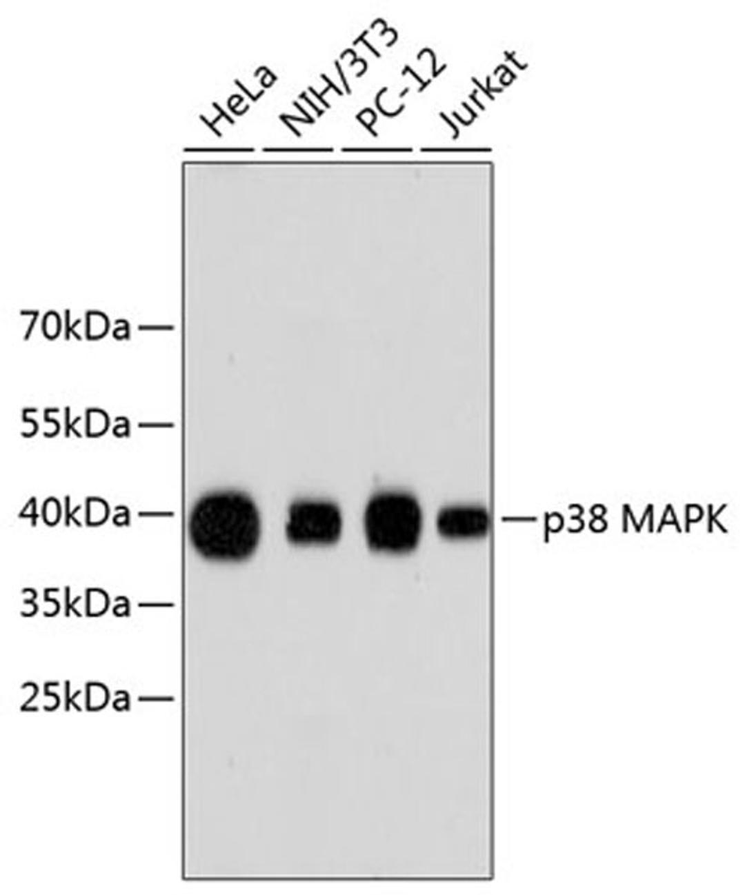 Western blot - p38 MAPK antibody (A10832)