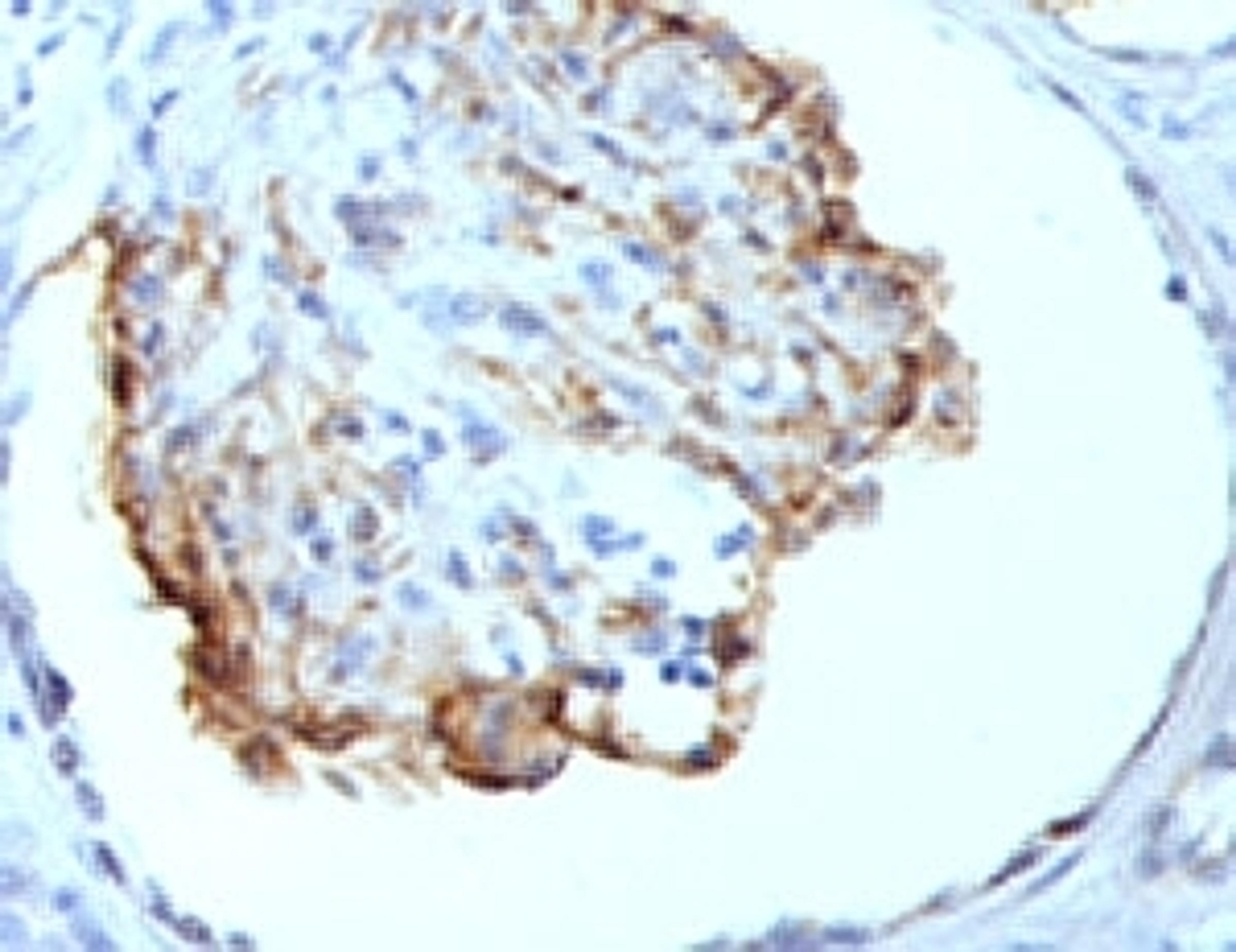 Formalin-fixed, paraffin-embedded human kidney stained with WT1 antibody (WT1/857).