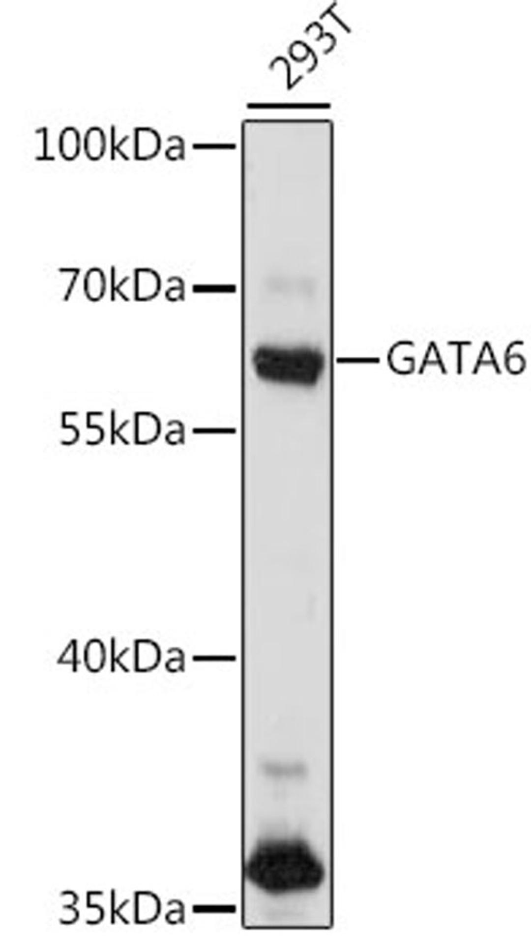 Western blot - GATA6 antibody (A16634)