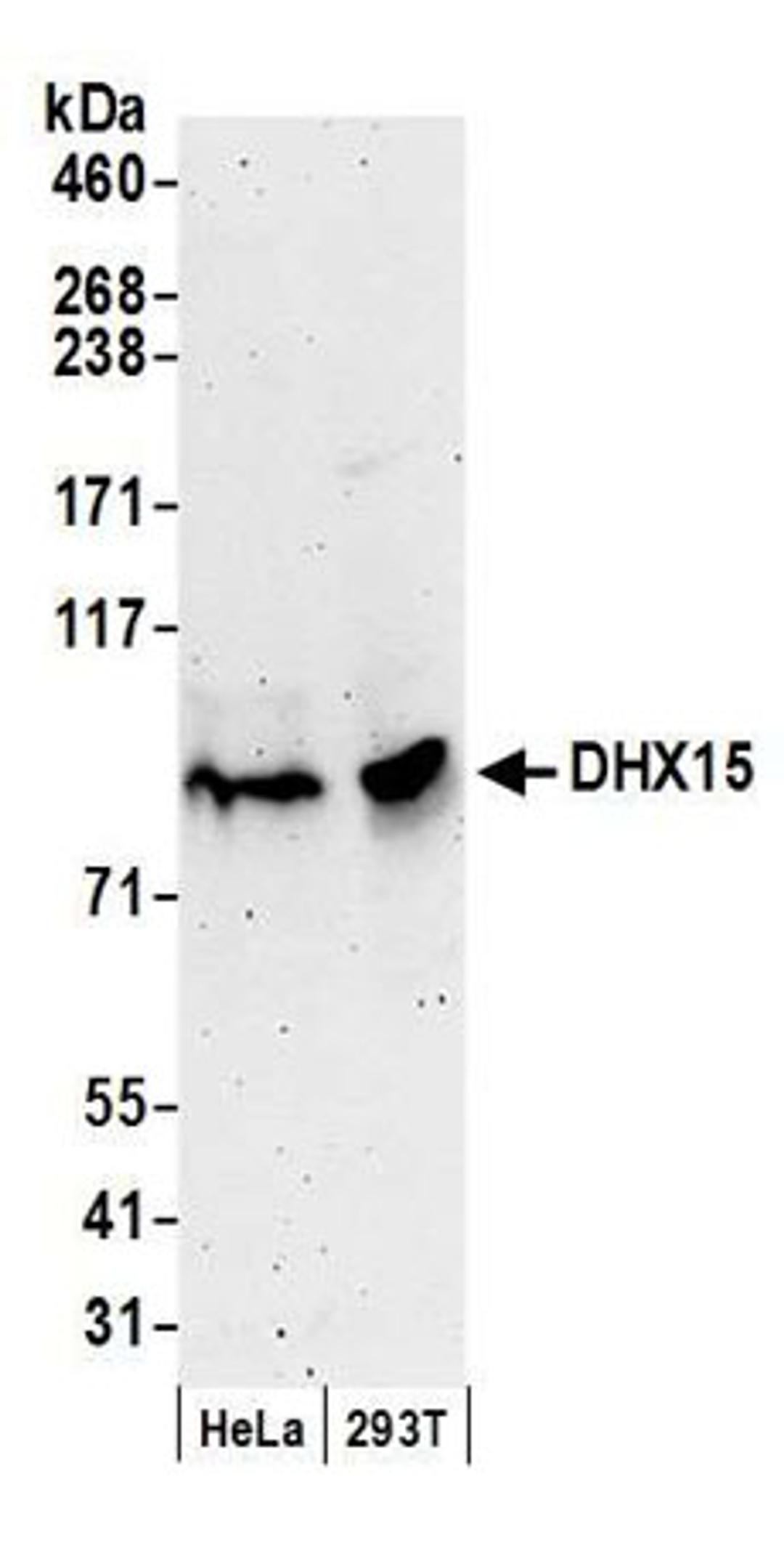 Detection of human DHX15 by western blot.