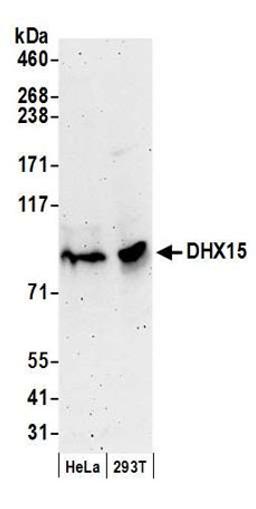 Detection of human DHX15 by western blot.