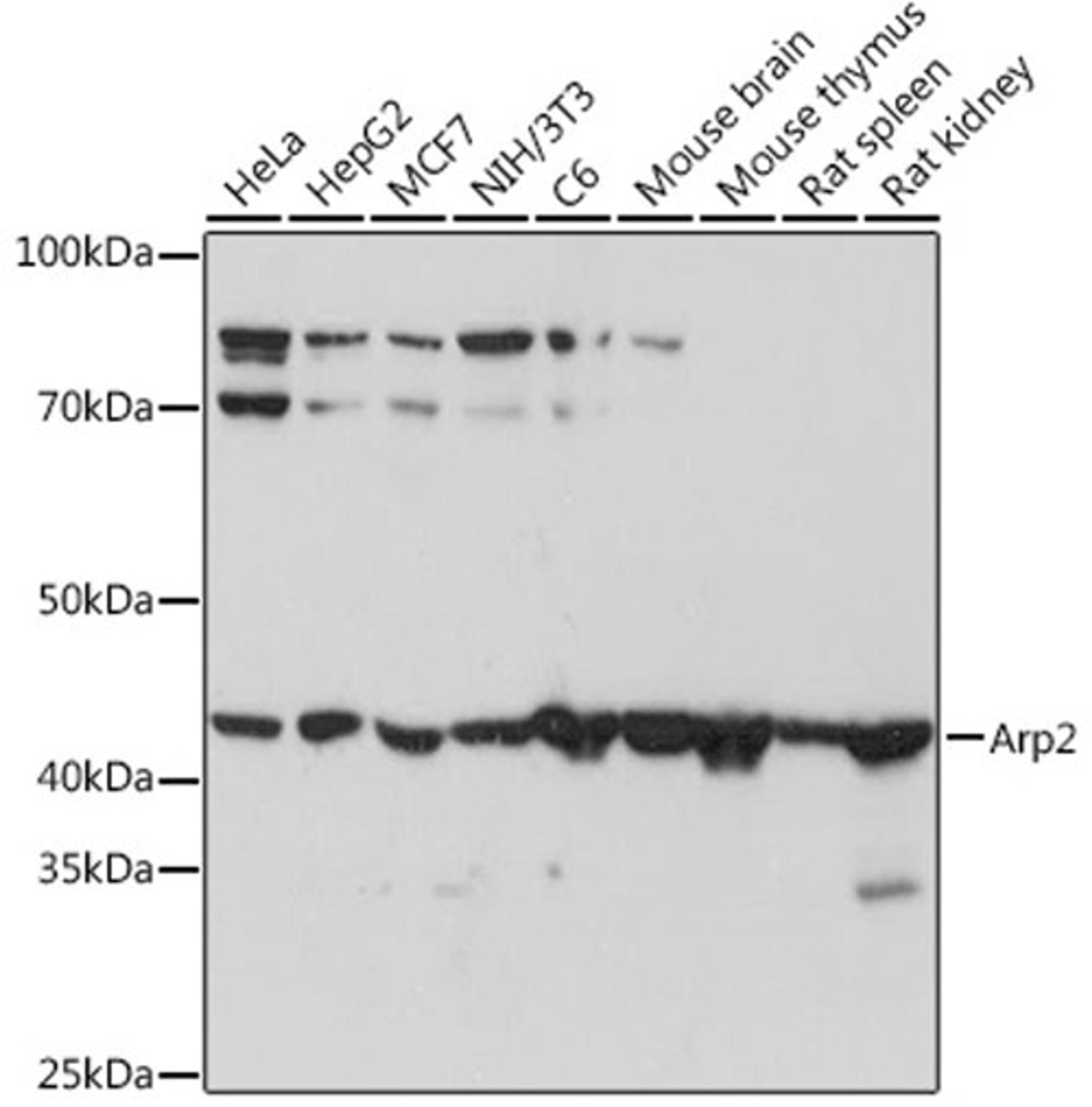 Western blot - Arp2 Rabbit mAb (A8876)