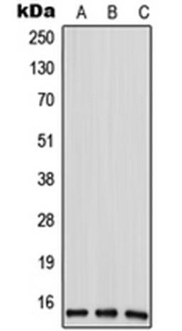 Western blot analysis of HeLa (Lane 1), mouse liver (Lane 2), rat liver (Lane 3) whole cell lysates using ANP32D antibody