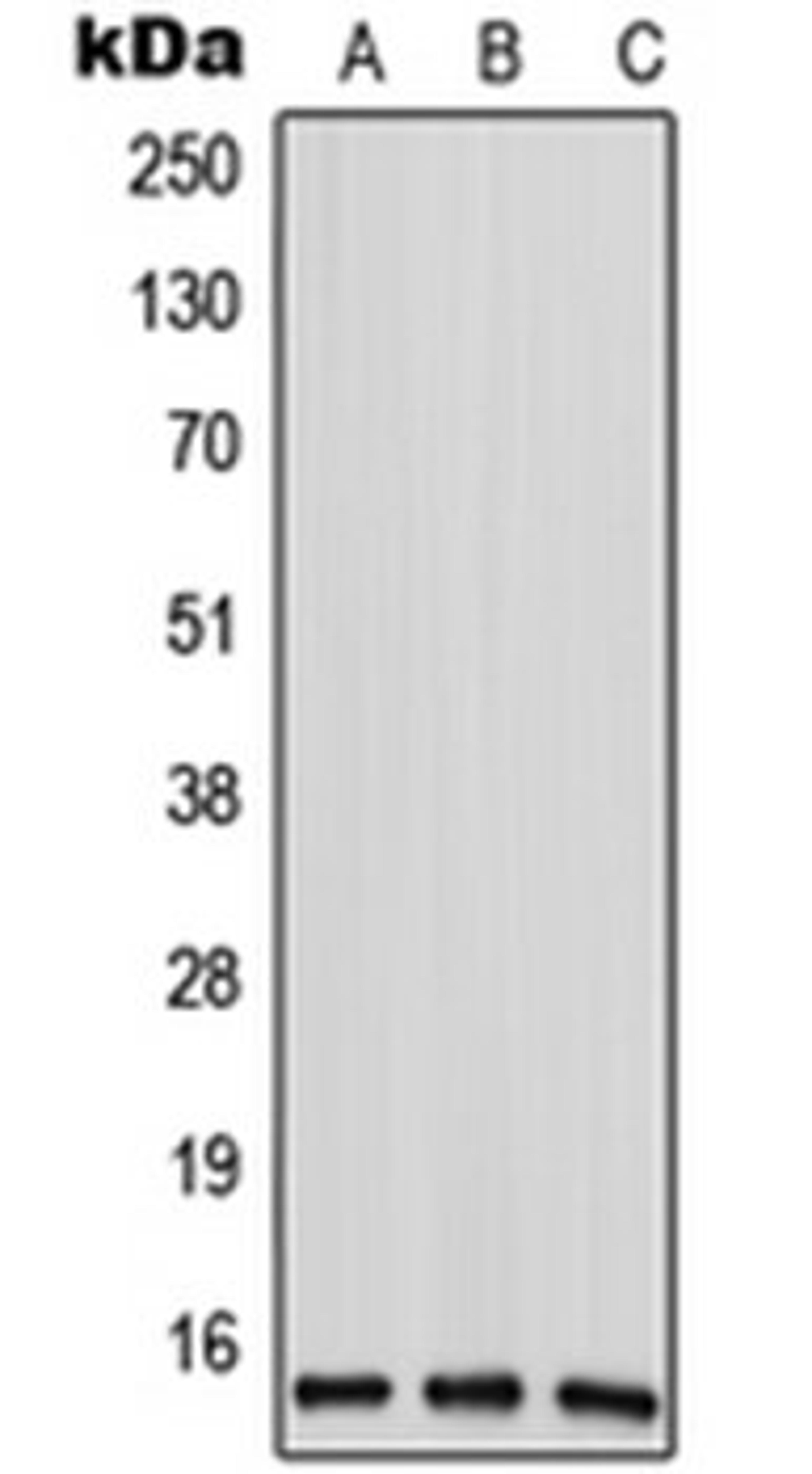 Western blot analysis of HeLa (Lane 1), mouse liver (Lane 2), rat liver (Lane 3) whole cell lysates using ANP32D antibody