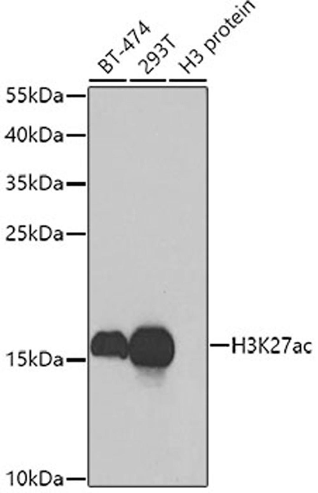 Western blot - Acetyl-Histone H3-K27 antibody (A7253)